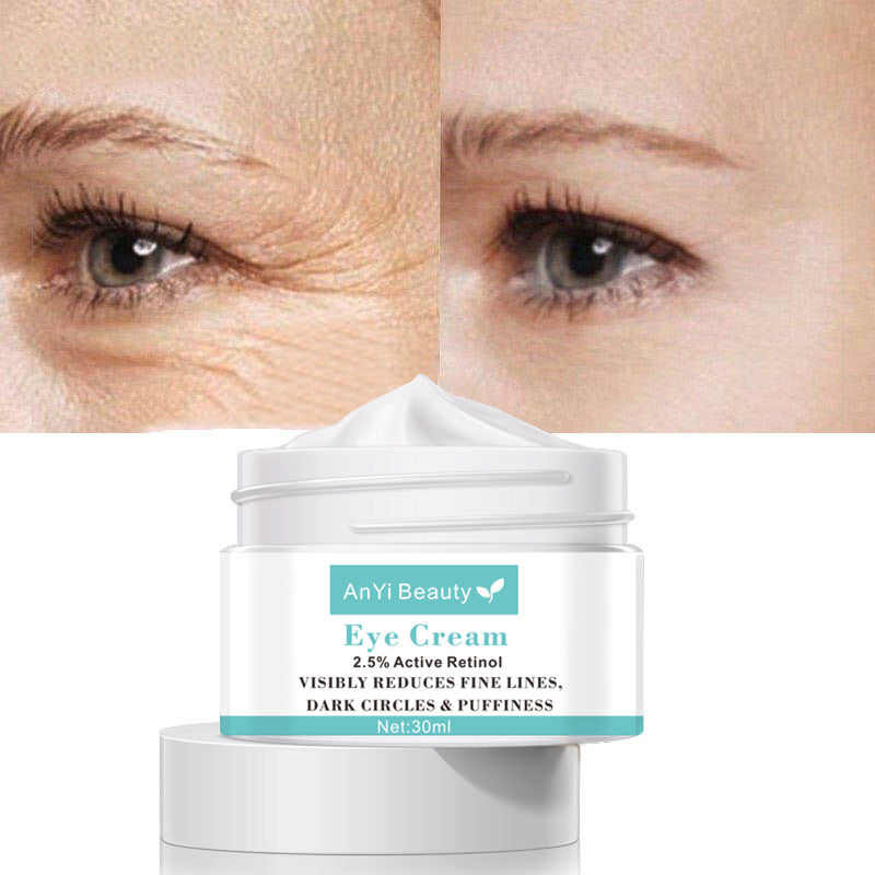 Person applying eye cream to reduce dark circles and puffiness