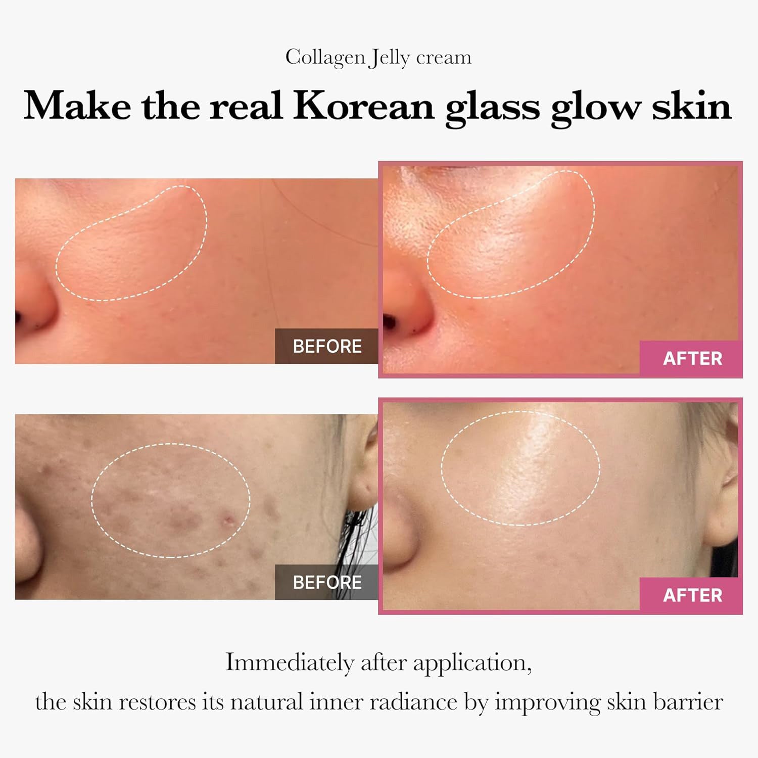 Person applying Triple Collagen Cream for glowing and rejuvenated skin