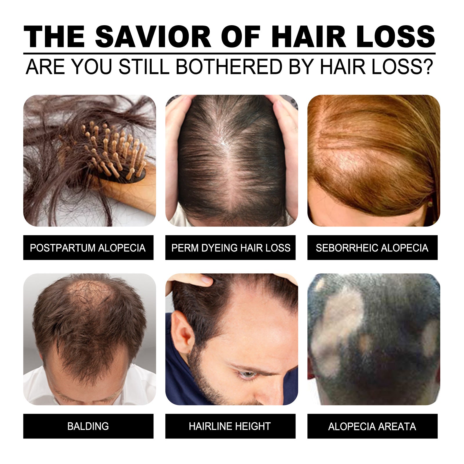 Before and after results using anti-dandruff and anti-itch shampoo for scalp health