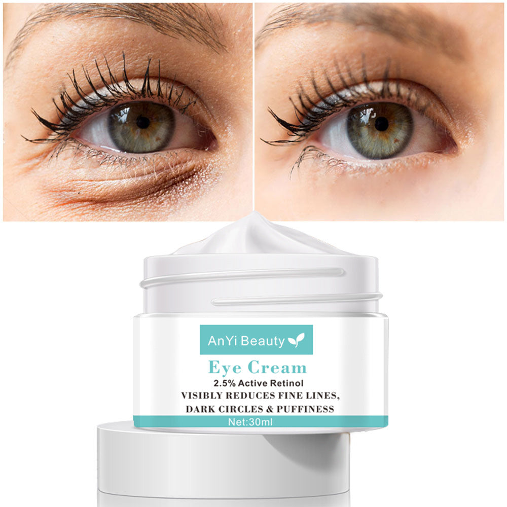 Person applying eye cream to reduce dark circles and puffiness